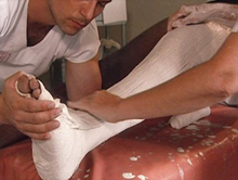 گچ شکسته‌بندی